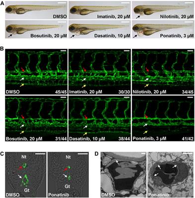 Evaluation of CML TKI Induced Cardiovascular Toxicity and Development of Potential Rescue Strategies in a Zebrafish Model